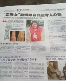 院方通报男子称做屁股整形遇假专家 院方通报男子称做屁股整形遇假专家