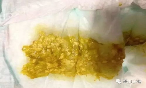 穿纸尿裤小孩坐绿豆框玩耍 超市回应(超市回应，穿纸尿裤小孩在绿豆框玩耍的现象观察与思考)