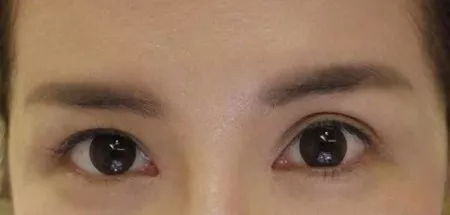 周深回应双眼皮贴被热掉了 周深回应双眼皮贴被热掉了